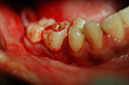 %_tempFileNameImplant%2011c3%