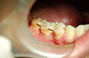 %_tempFileNameImplant%2011c6%