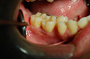%_tempFileNameImplant%2011c8%