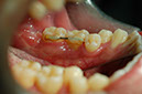 %_tempFileNameImplant%2011d1%