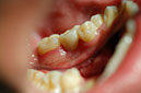 %_tempFileNameImplant%2011d2%