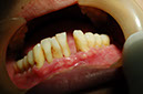 %_tempFileNameImplant%2012b1%
