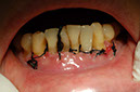 %_tempFileNameImplant%2012d1%