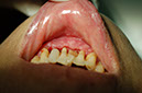 %_tempFileNameImplant%2012e1%