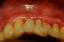 %_tempFileNameImplant%2012g3%