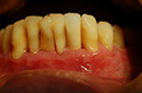 %_tempFileNameImplant%2012g5%