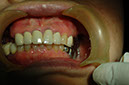 %_tempFileNameImplant%2015a1%