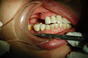 %_tempFileNameImplant%2015a2-1%