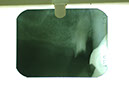 %_tempFileNameImplant%2015a2-2%