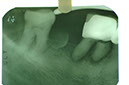%_tempFileNameImplant%2015a2-3%