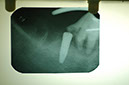 %_tempFileNameImplant%2015a2-5%