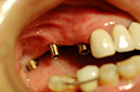 %_tempFileNameImplant%2015a3-1%
