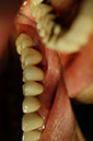 %_tempFileNameImplant%2015a3-2%
