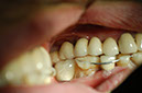 %_tempFileNameImplant%2015a3-3%