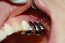 %_tempFileNameImplant%2015a5%