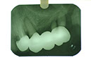 %_tempFileNameImplant%2015a6%