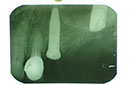 %_tempFileNameImplant%2015a7%