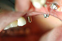 %_tempFileNameImplant%2015c1%