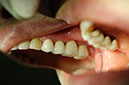 %_tempFileNameImplant%2015c2%
