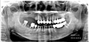 %_tempFileNameImplant%2015d1%