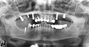 %_tempFileNameImplant%2015d2%