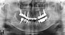 %_tempFileNameImplant%2015d3%