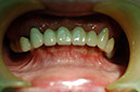 %_tempFileNameImplant%2017a1%