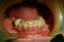 %_tempFileNameImplant%2017a2%