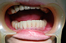 %_tempFileNameImplant%2017b1%