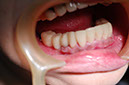 %_tempFileNameImplant%2017b2%