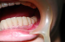 %_tempFileNameImplant%2017b3%
