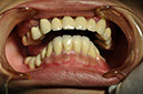 %_tempFileNameImplant%2017c2%
