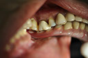 %_tempFileNameImplant%2017c5%