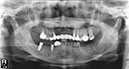 %_tempFileNameImplant%2017d1%