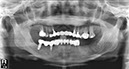 %_tempFileNameImplant%2017d2%