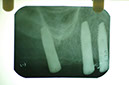 %_tempFileNameImplant%2018c%