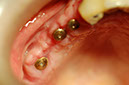 %_tempFileNameImplant%2018d1%