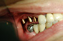 %_tempFileNameImplant%2018d2%