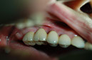 %_tempFileNameImplant%2018d3%