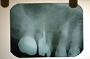 %_tempFileNameImplant%2023a1%