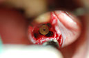 %_tempFileNameImplant%2023b1%