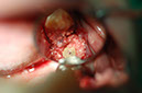%_tempFileNameImplant%2023b2%
