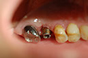 %_tempFileNameImplant%2023c1%