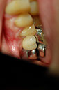 %_tempFileNameImplant%2023c3%