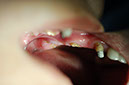 %_tempFileNameImplant%2024a0%