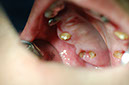 %_tempFileNameImplant%2024a1%