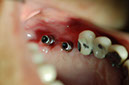 %_tempFileNameImplant%2024a2%