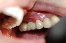 %_tempFileNameImplant%2024c1%
