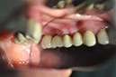 %_tempFileNameImplant%2024c2%