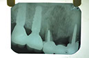 %_tempFileNameImplant%2024d3%